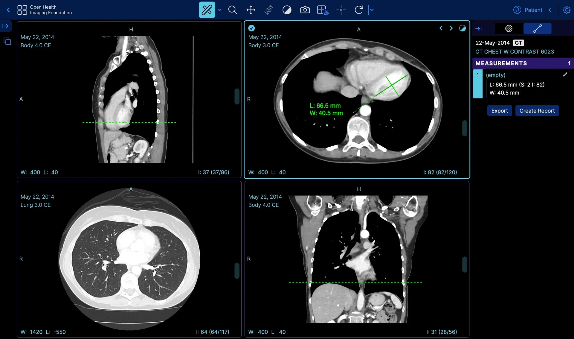 DBD PACS Viewer — ระบบดูภาพ DICOM CT Chest